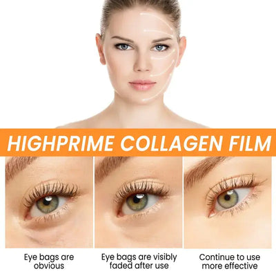Before and after photos showcasing EELHOE Collagen Eye Mask for Puffiness effectiveness on under-eye puffiness.