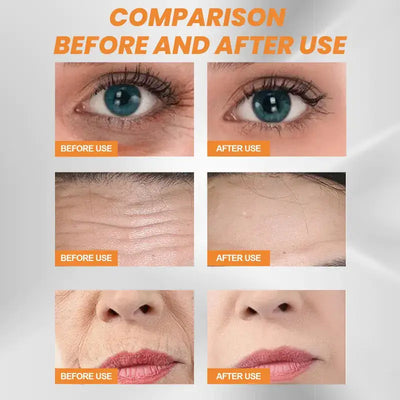 Comparison of results using EELHOE Collagen Eye Mask for Puffiness before and after application.