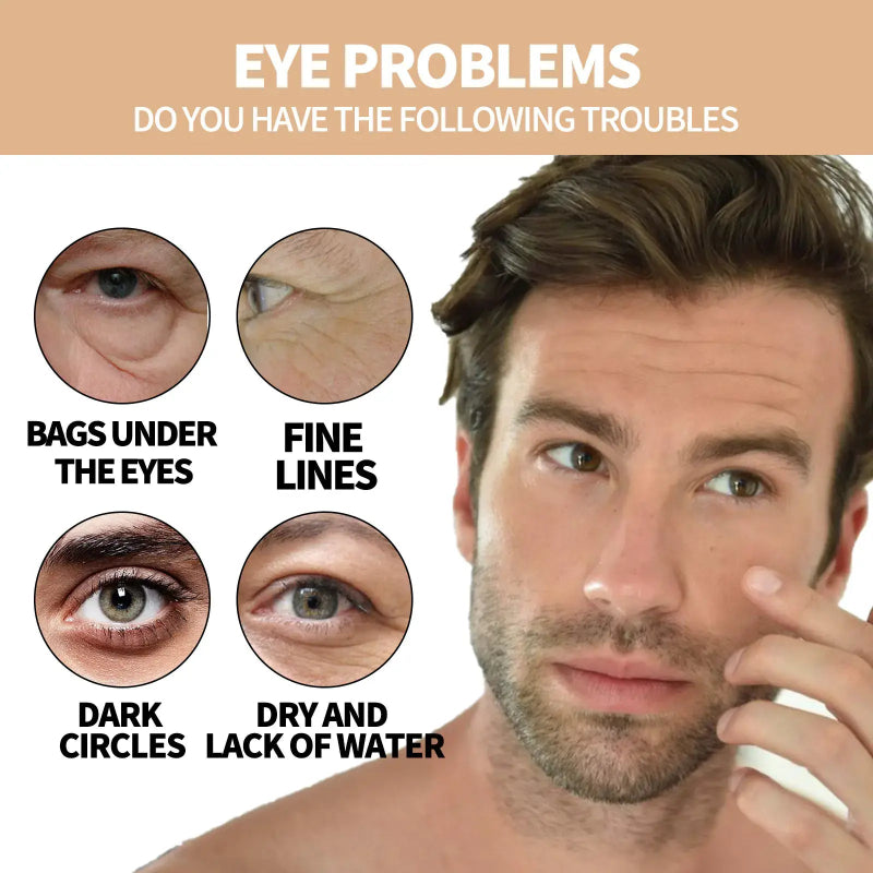 Eye problems including bags under the eyes, fine lines, dark circles, and dry skin; targeting Hydrating Eye Roller for Dark Circles.